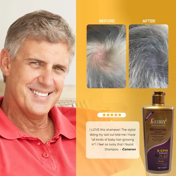 Hair Shampoo Anti-off Hår Vækst Naturlige urteekstrakter Hår genvækst Hurtigt Shampoo Professionel Pleje 425 ml Gratis Fragt