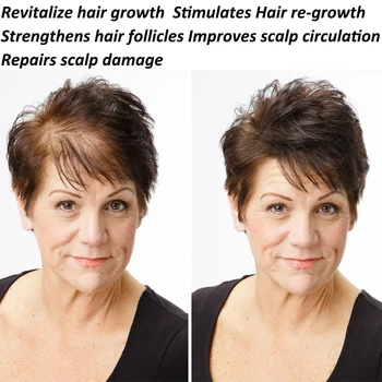 Hair Shampoo Anti-off Hår Vækst Naturlige urteekstrakter Hår genvækst Hurtigt Shampoo Professionel Pleje 425 ml Gratis Fragt