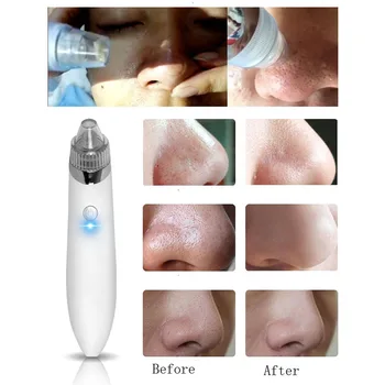 Healthsweet Comedo Hudorm Vakuumsug Diamant Fjernelse Wrink Acne Pore Peeling Ansigt Ren Facial Hud Pleje, Skønhed Maskine