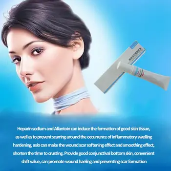 Nuobisong Facial Ar Fjernelse Cremas Facial Behandling Whitening Creme Til Ansigtet Strækmærker Fugtgivende